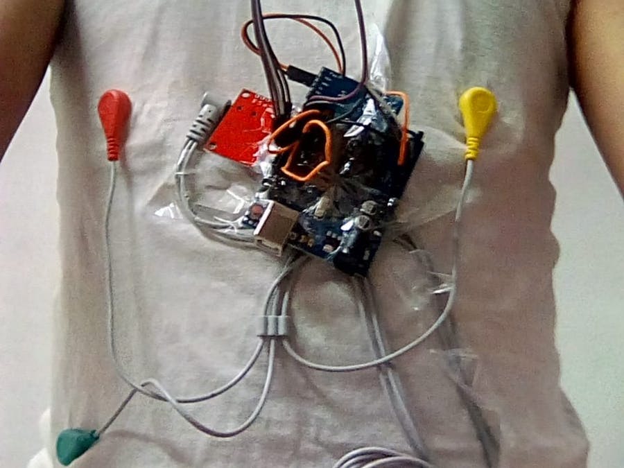 基于 AD8232 的心电监护仪（示意图+代码+3D模型+应用程序）